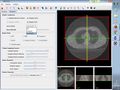 Thumbnail for version as of 15:57, 5 September 2016
