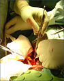 Thumbnail for version as of 11:14, 19 October 2007