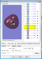 Thumbnail for version as of 15:56, 25 February 2016