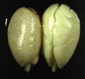 Thumbnail for version as of 15:08, 21 October 2006
